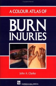 A Colour Atlas of Burn Injuries (Chapman & Hall Medical Atlas Series, 9)