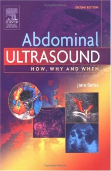 Abdominal Ultrasound How, Why and When