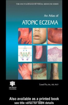 An Atlas of Atopic Eczema (Encyclopedia of Visual Medicine Series)