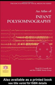 An Atlas of Infant Polysomnography