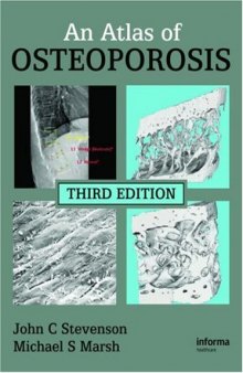 An Atlas of Osteoporosis, Third Edition
