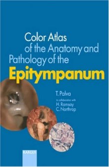 Colour Atlas of the Anatomy and Pathology of the Epitympanum