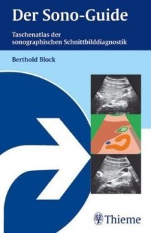 Der Sono-Guide. Taschenatlas der sonographischen Schnittbilddiagnostik.