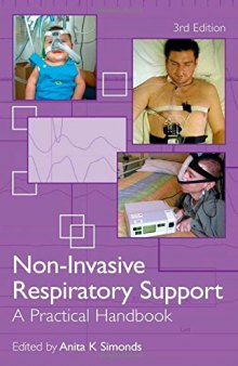 Non-Invasive Respiratory Support: A Practical Handbook
