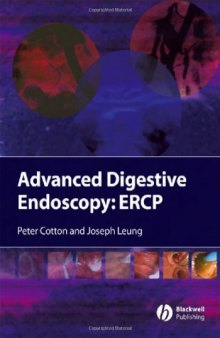 Advanced digestive endoscopy : ERCP