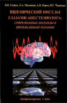 Ишемический инсульт глазами анестезиолога