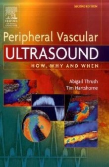 Peripheral vascular ultrasound: how, why, and when
