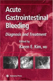 Acute Gastrointestinal Bleeding: Diagnosis and Treatment (Clinical Gastroenterology)