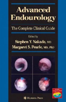 Advanced Endourology The Complete Clinical Guide