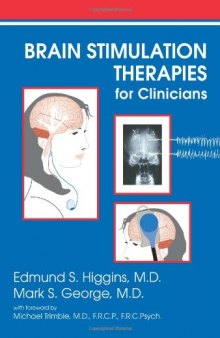 Brain Stimulation Therapies for the Clinician