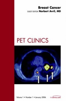 Breast Cancer, An Issue of PET Clinics