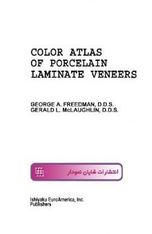 Color atlas of Laminate porcelain Veneers