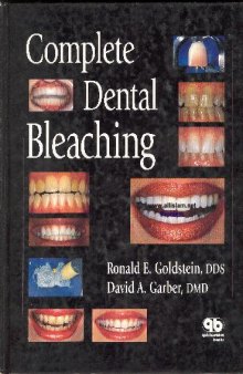 Complete Dental Bleaching