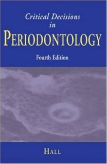 Critical decisions in periodontology