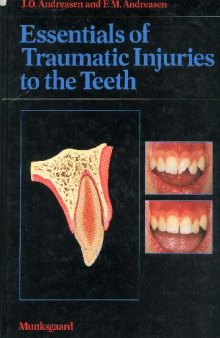 essentials of traumatic injuries to the teeth