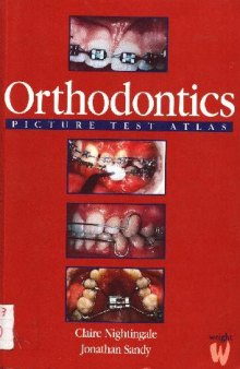 orthodontics picture test atlas