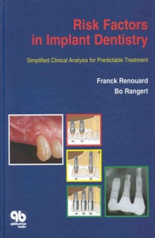 Risk factors in implant dentistry