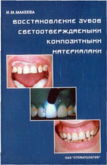 Восстановление зубов светоотверждаемыми композитными материалами