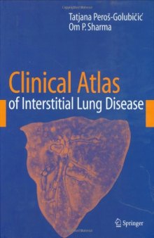 Clinical Atlas of Interstitial Lung Disease