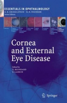 Cornea and external eye disease