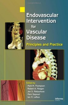 Endovascular Intervention for Vascular Disease: Principles and Practice
