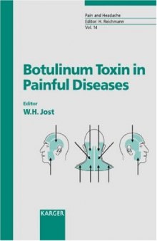 Botulinum Toxin in Painful Diseases (Pain and Headache)