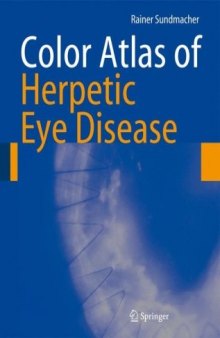 Color Atlas of Herpetic Eye Diseases: A Practical Guide to Clinical Management