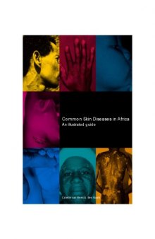Common Skin Diseases in Africa : an Illustrated Guide