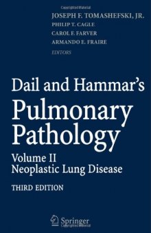 Dail and Hammar’s Pulmonary Pathology: Volume II: Neoplastic Lung Disease