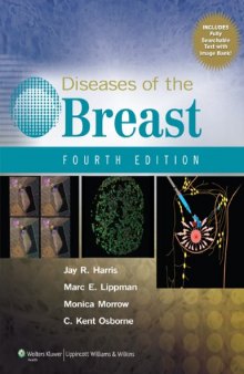 Diseases of the Breast, 4th Edition