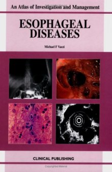 Esophageal Diseases: An Atlas of Investigation and Management