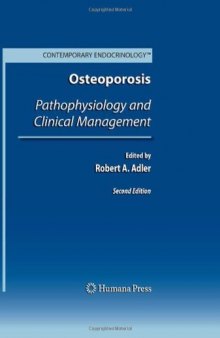 Osteoporosis: Pathophysiology and Clinical Management (Contemporary Endocrinology)