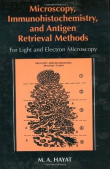 Microscopy, immunohistochemistry, and antigen retrieval methods: for light and electron microscopy