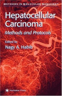 Hepatocellular Carcinoma: Methods and Protocols (Methods in Molecular Medicine)