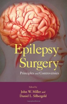 Epilepsy Surgery: Principles and Controversies (Neurological Disease and Therapy)