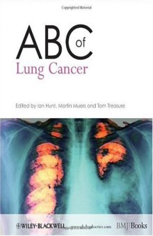 ABC of Lung Cancer (ABC Series)