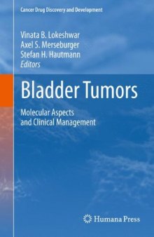 Bladder Tumors:: Molecular Aspects and Clinical Management