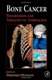 Bone Cancer: Progression and Therapeutic Approaches, 1st Edition