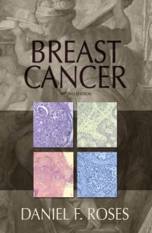 Breast Cancer (2nd Edition)