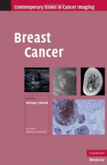 Breast Cancer (Contemporary Issues in Cancer Imaging)
