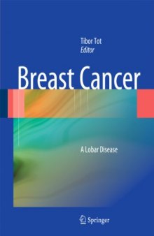 Breast Cancer: A Lobar Disease