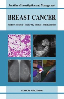 Breast Cancer: An Atlas of Investigation and Management (Atlases of Investigation and Management)