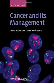 Cancer and its Management, Sixth Edition