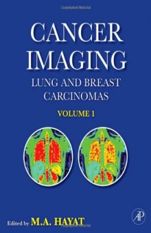 Cancer Imaging, Volume 1: Lung and Breast Carcinomas (Cancer Imaging)