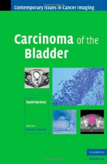 Carcinoma of the Bladder (Contemporary Issues in Cancer Imaging)