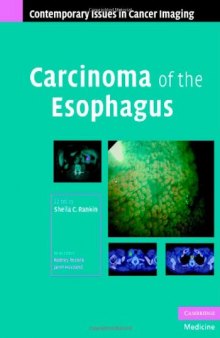 Carcinoma of the Esophagus (Contemporary Issues in Cancer Imaging)