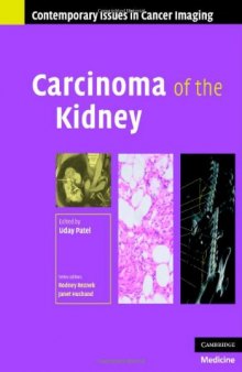 Carcinoma of the Kidney (Contemporary Issues in Cancer Imaging)
