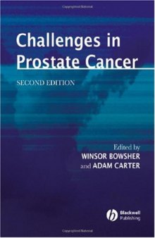 Challenges in Prostate Cancer, 2nd edition