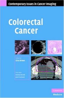 Colorectal Cancer (Contemporary Issues in Cancer Imaging)
