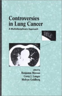 Controversies in Lung Cancer: A Multidisciplinary Approach (Basic and Clinical Oncology)